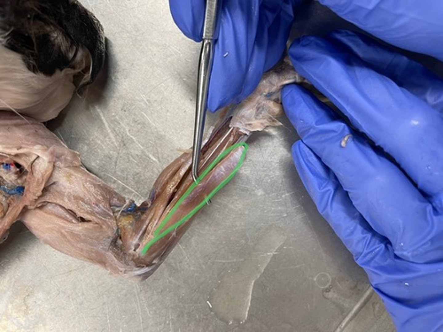 <p>O: medial epicondyle of humerus</p><p>I: palmar aponeurosis</p><p>A: flexes wrist (weakly)</p>