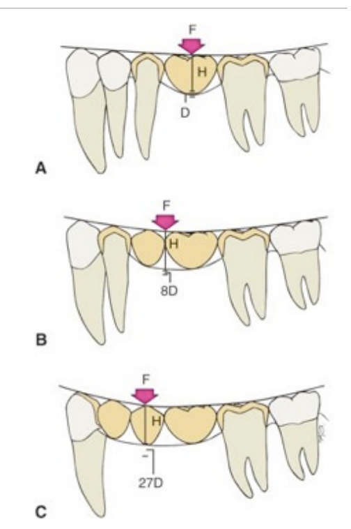 <p>span of edentulous site: bending or deflection varies directly with the cube of the length and inversely w the cube of the occlusogingival thickness of the pontic</p>