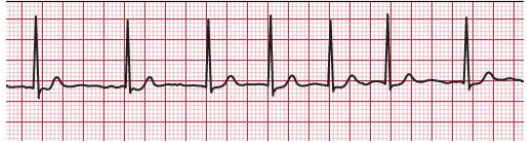 <p>What rhythm is this?</p>