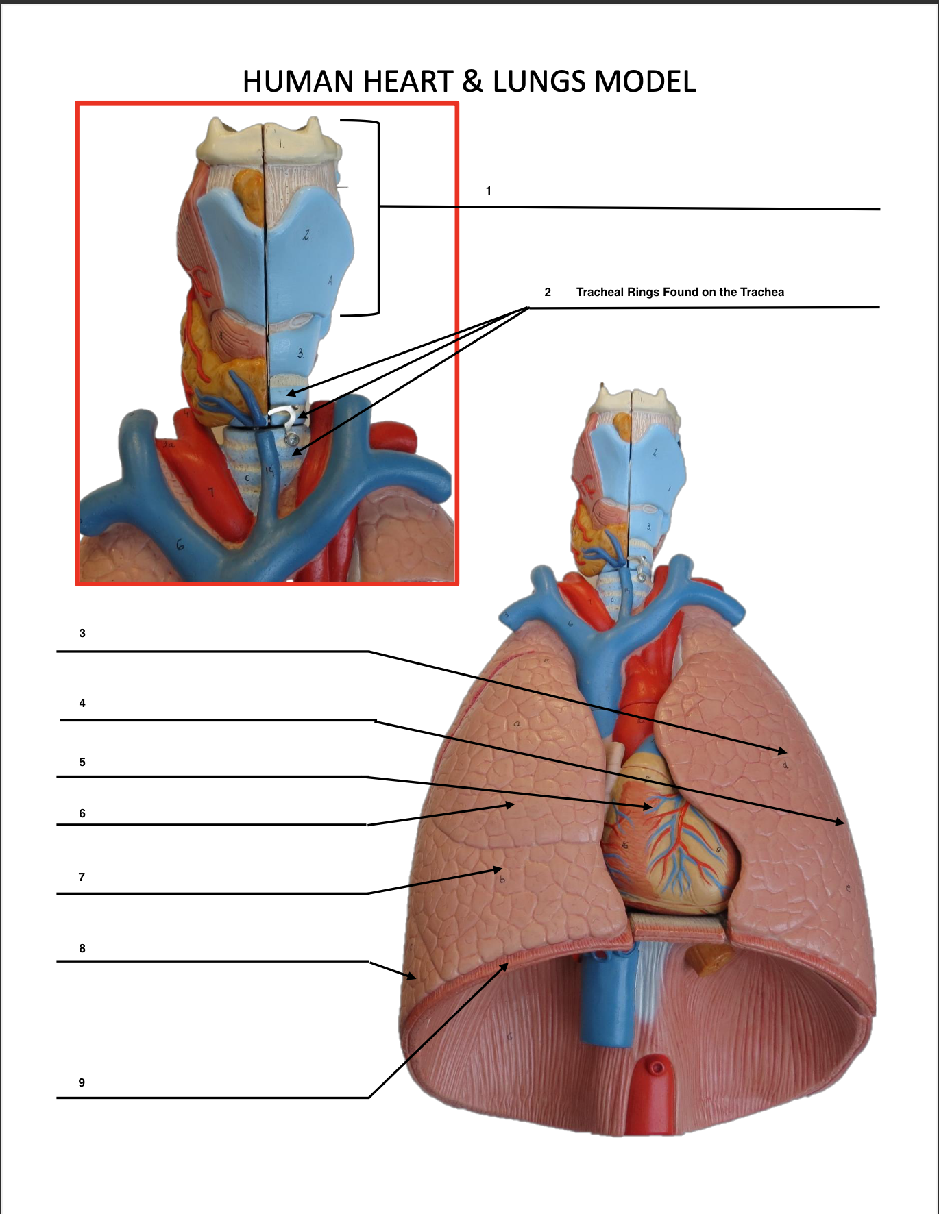 <p>Tracheal Rings</p>