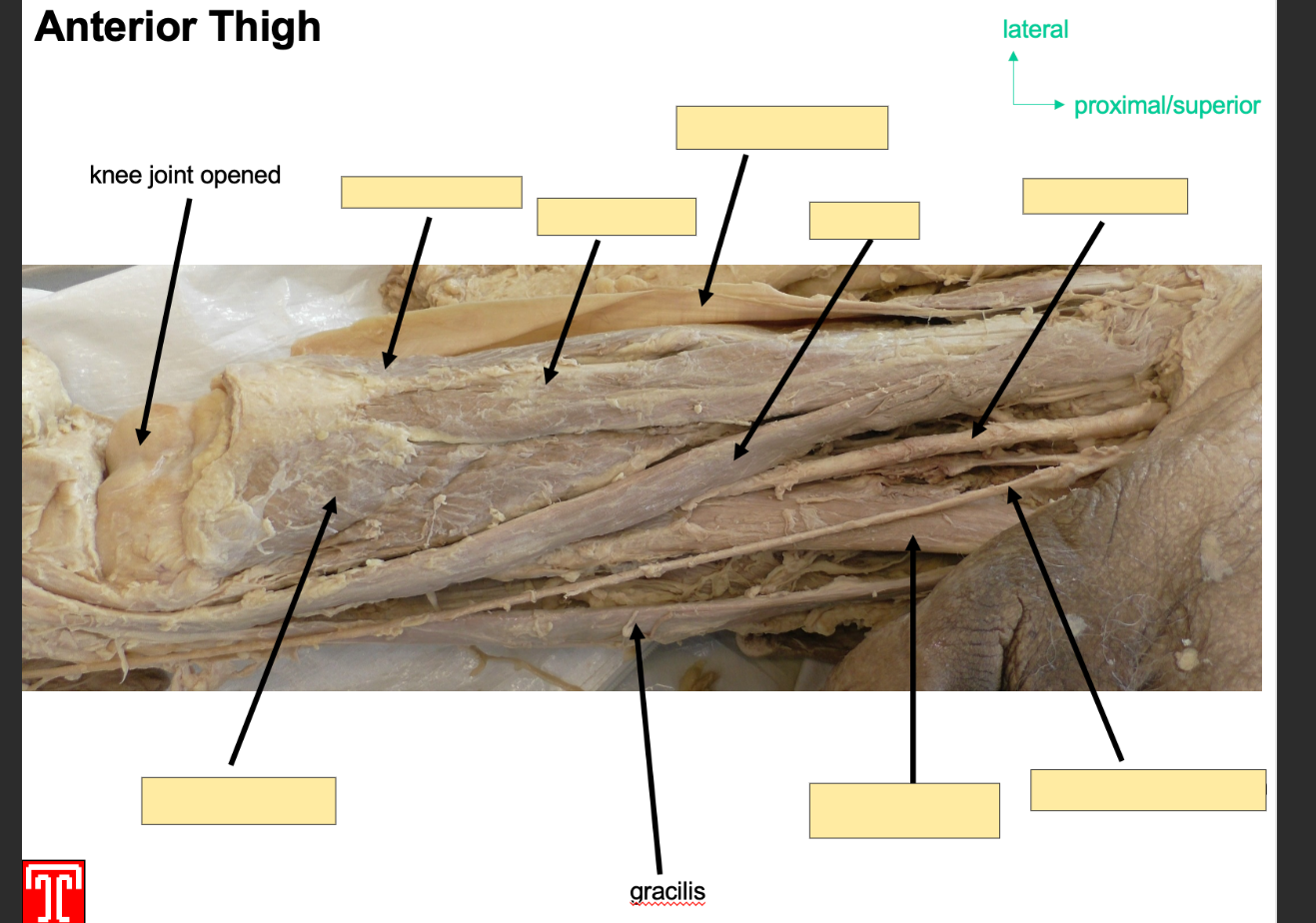 <p>superficial medial comaprtment of thigh miscle, crosses hip and knee joints </p><p></p><p>attachmentL originates from inferior rami of pubis, decsends down medial aspect of thigh and attaches to medial surface of tibial shaft </p><p></p><p>action adduction of thigh at hip and flexion of leg at knee </p><p></p><p>innervationL obturator nerve</p><p></p><p>artertyL obturtor arterty </p>
