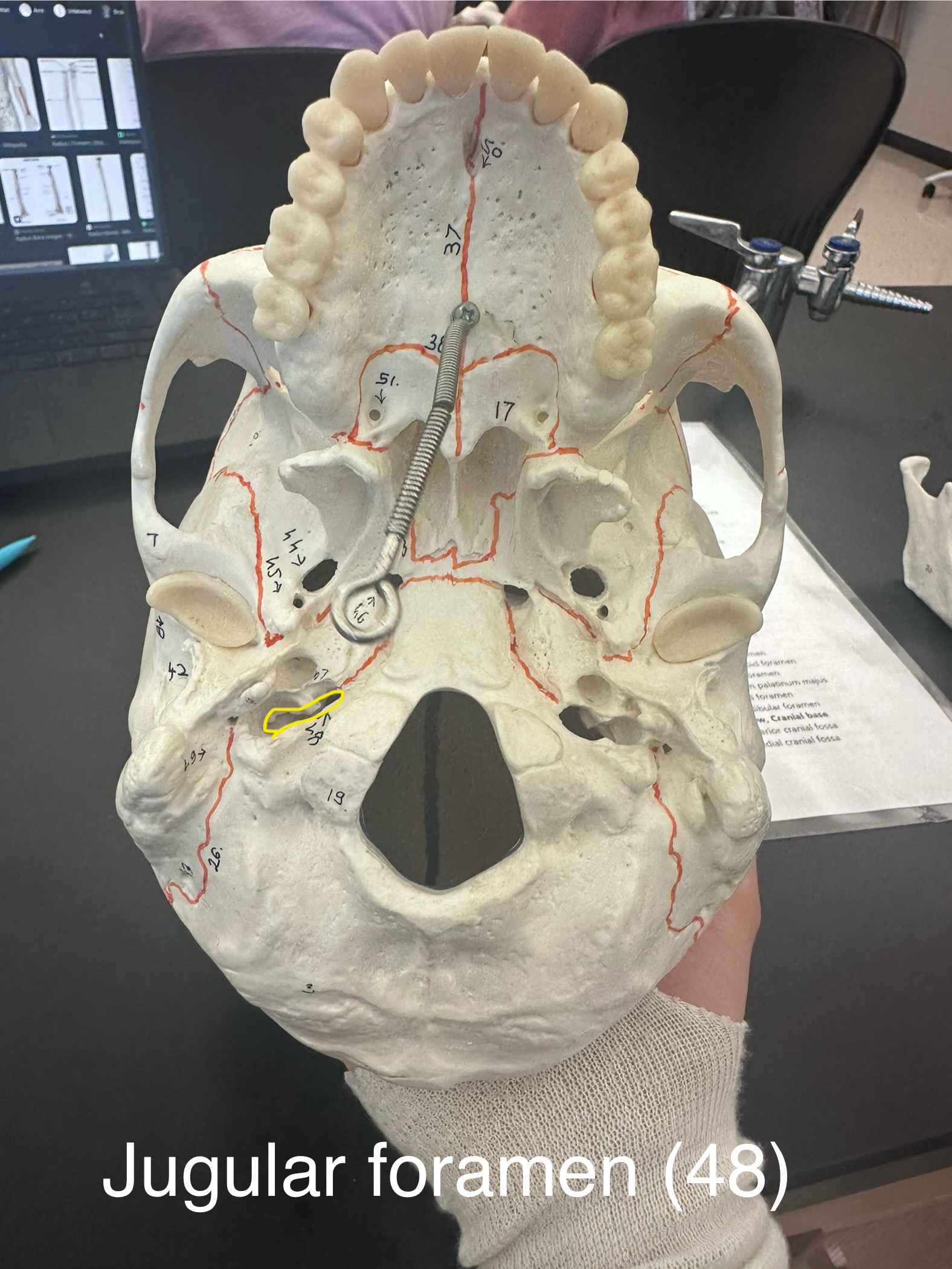 <p>Jugular Foramen</p>