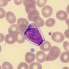 <p>What is this leukocyte?</p>