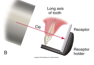 <ul><li><p>Receptor placement: Position the image receptor so that it will cover the correct teeth to be examined</p></li><li><p>Receptor position: the image receptor must be positioned parallel to the long axis of the tooth</p></li><li><p>Vertical angulation: the central ray of the x-ray beam must be directed perpendicular to the image receptor nd the long axis of the tooth</p></li><li><p><span style="font-size: 7pt; font-family: "Times New Roman""> </span>Horizontal angulation: the central ray of the x-ray beam through the contact areas between the teeth</p></li><li><p>Film receptor exposure: The X-ray beam must be centered on the receptor to ensure that all areas are exposed. Failure to do so will result in “cone cut.”</p></li></ul><p></p>