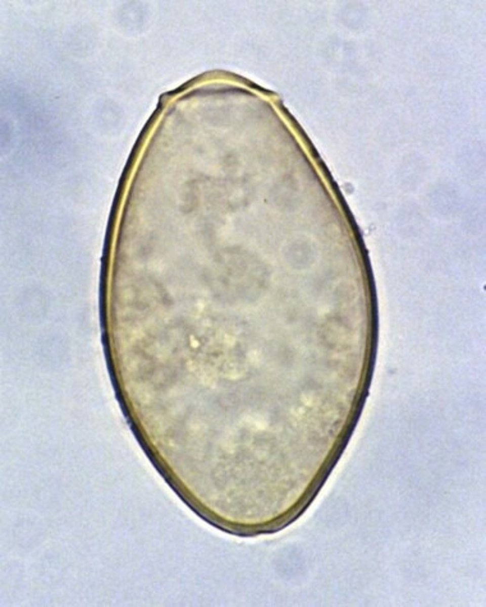 <p>- Type of trematode</p><p>- Acquired from eating metacercariae in raw crabs and crayfish</p><p>- Found in Asia, Oceania, Africa, and South and Central America</p><p>- Several million cases in Asia</p>