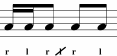 <p>What Variation is This? </p>