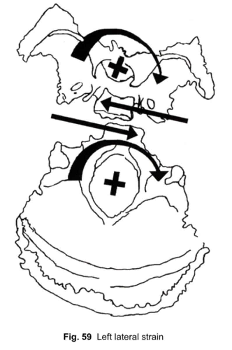 <p>Define Lateral Strain</p>