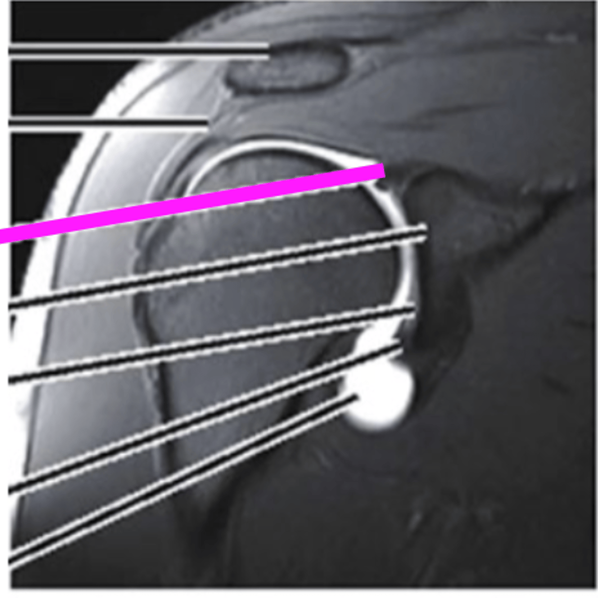 <p>what does the pink line point to?</p>