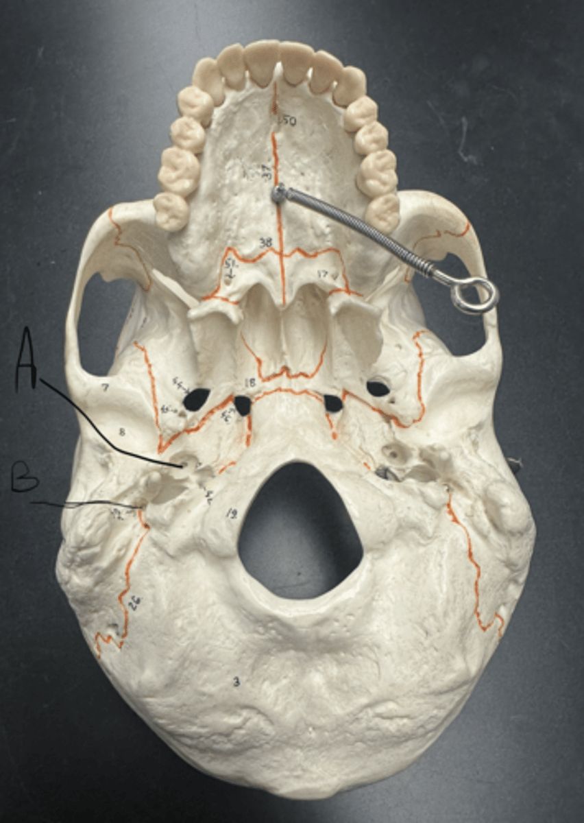 knowt flashcard image