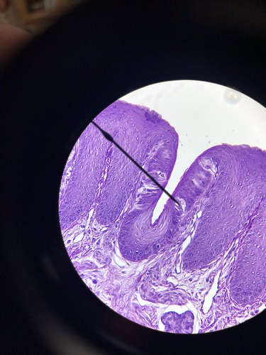 Label the organ and structure