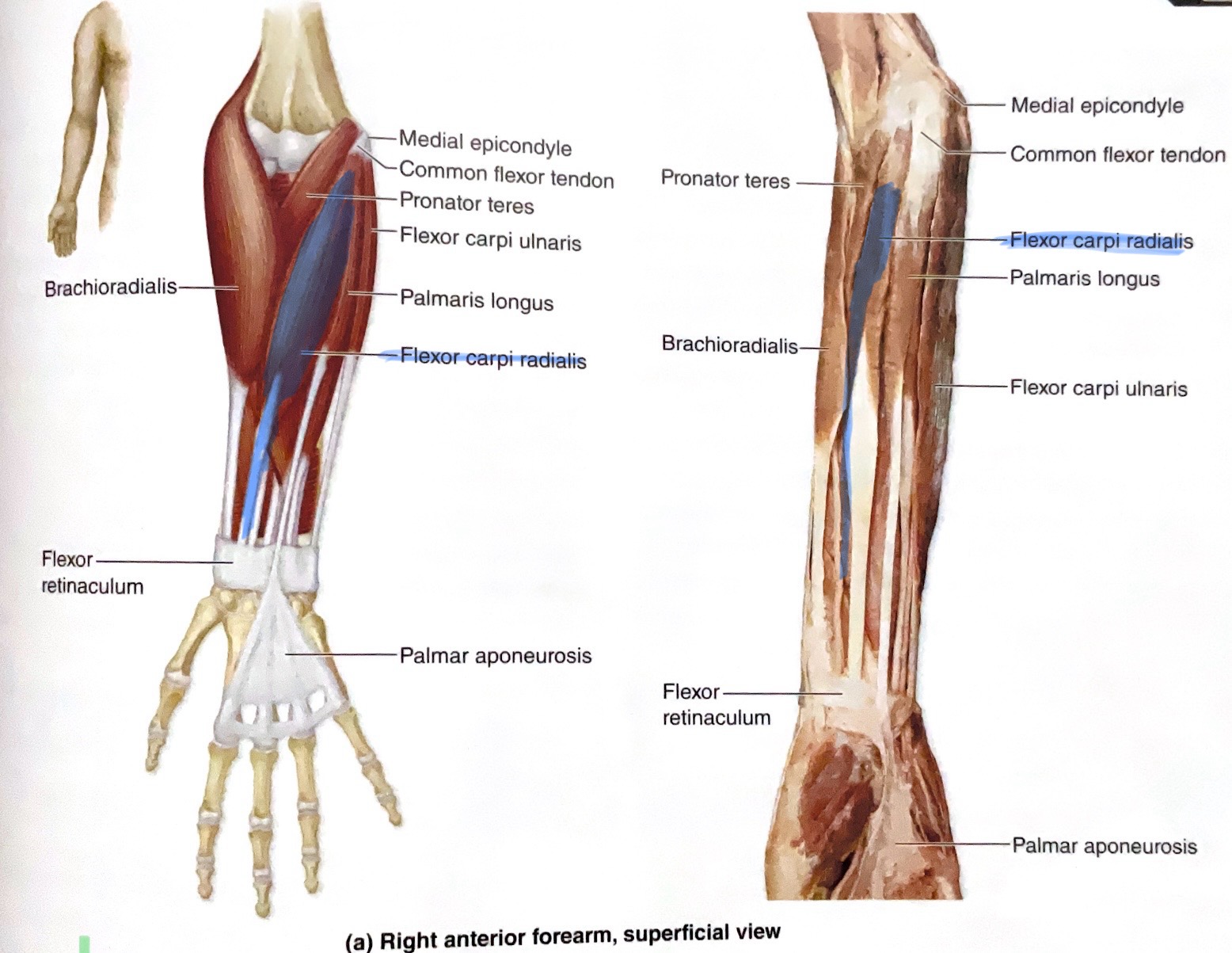 <p>Action: Flex, abduct wrist </p>