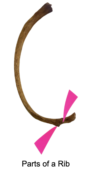<p>The "articulating part" of the tubercle of a rib is for what part of the transverse process:</p><p>A. Joint</p><p>B. Ligament</p><p>C. Tendon</p><p>D. Artery-&amp;-Vein</p>