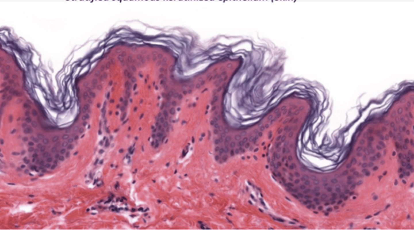 <p>Identify the type of epithelia</p>