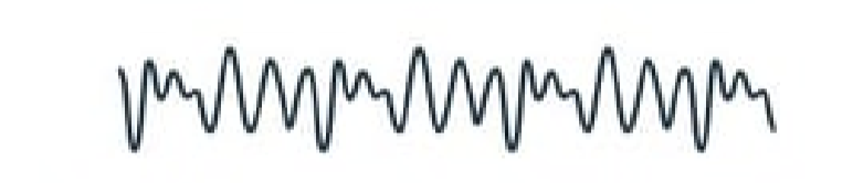<p><strong>Q:</strong> What does alpha frequency represent in EEG?</p>