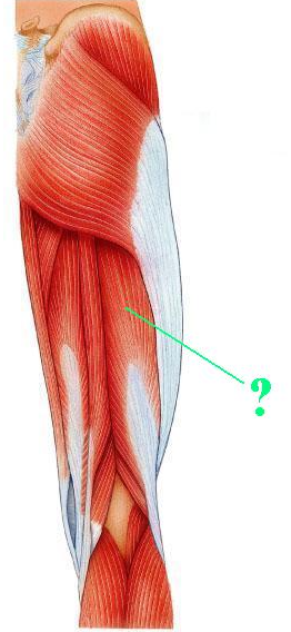 <p><span>Identify the indicated muscle.</span></p>