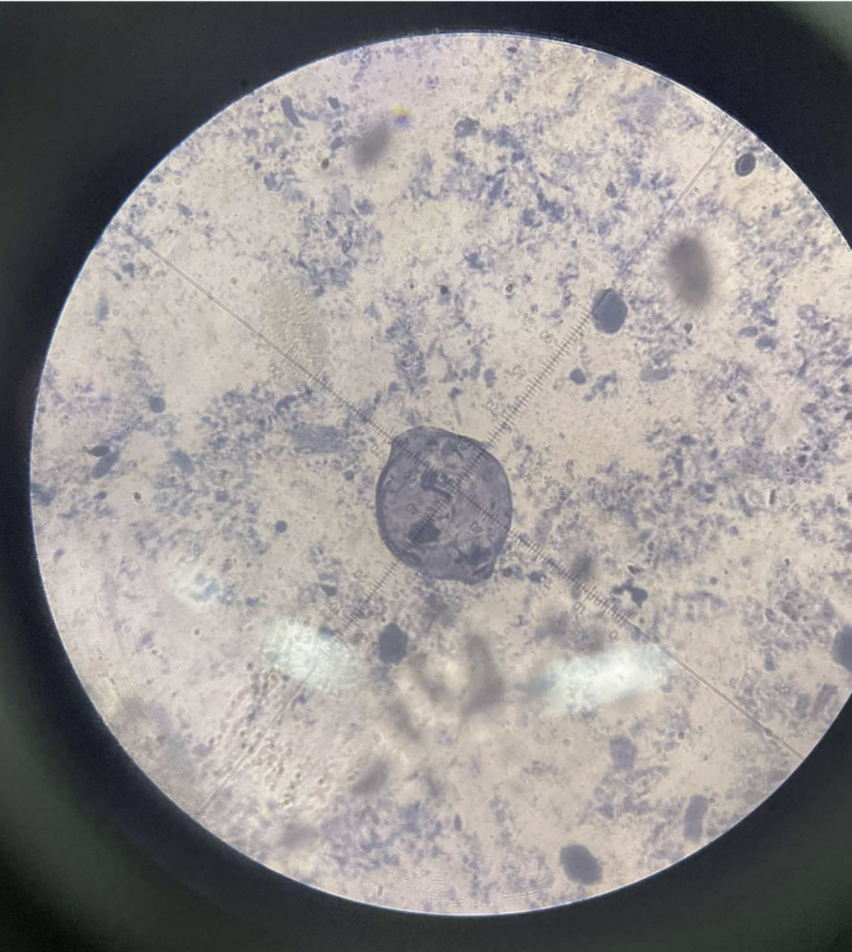 <p>specimen</p><p>phylum</p><p>color</p><p>shape</p><p>cell arrangement</p><p>motility</p><p></p><p>found</p><p></p><p>disease</p><p>prevention</p><p>treatment</p><p></p><p>life cycle</p><p></p>
