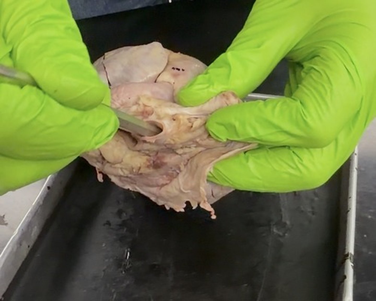 <p>Branching off of the aortic arch</p>