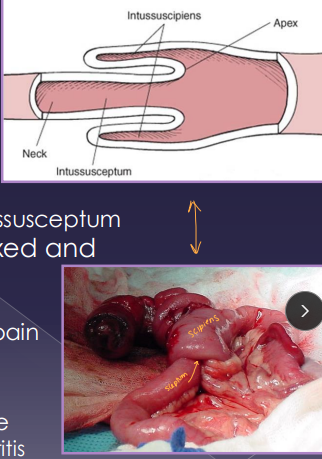 <p><span>Intussusception</span></p>