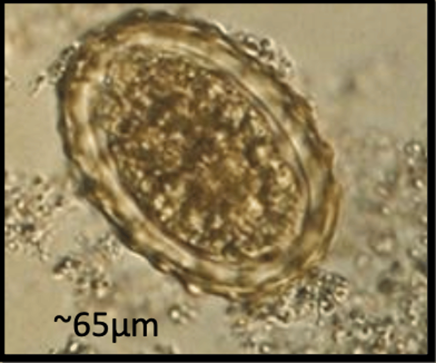 <p>Found in pigs which are persistently coughing and have visible worm blockages in the small intestine on ultrasound. What parasite species does this egg belong to?</p>