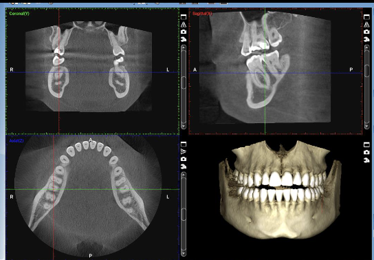 <p>Tomographic images in 3D created from many 2D projection images using ionizing radiation</p><p></p><p>— series of projections</p>