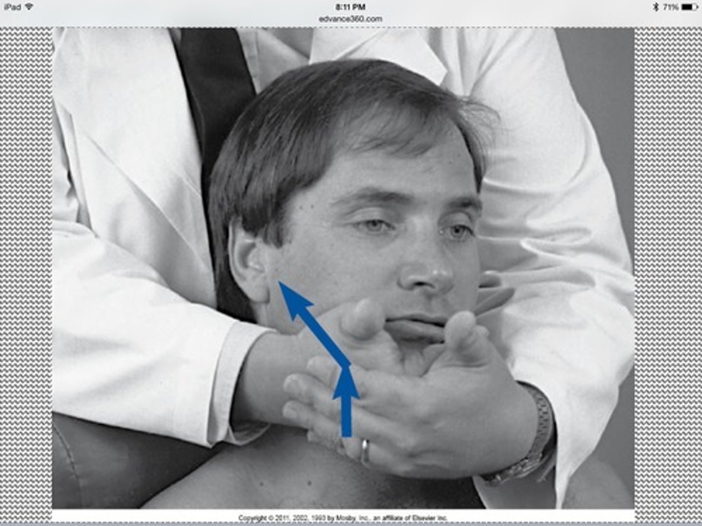 <p>Pain with compression of the retrodiscal tissue</p>