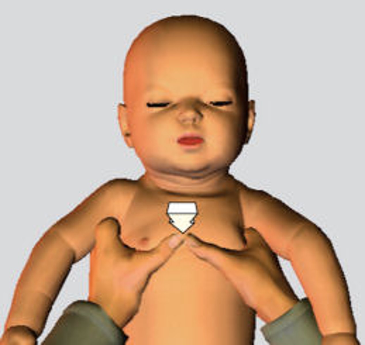 <p>2 thumb-encircling hands technique</p>