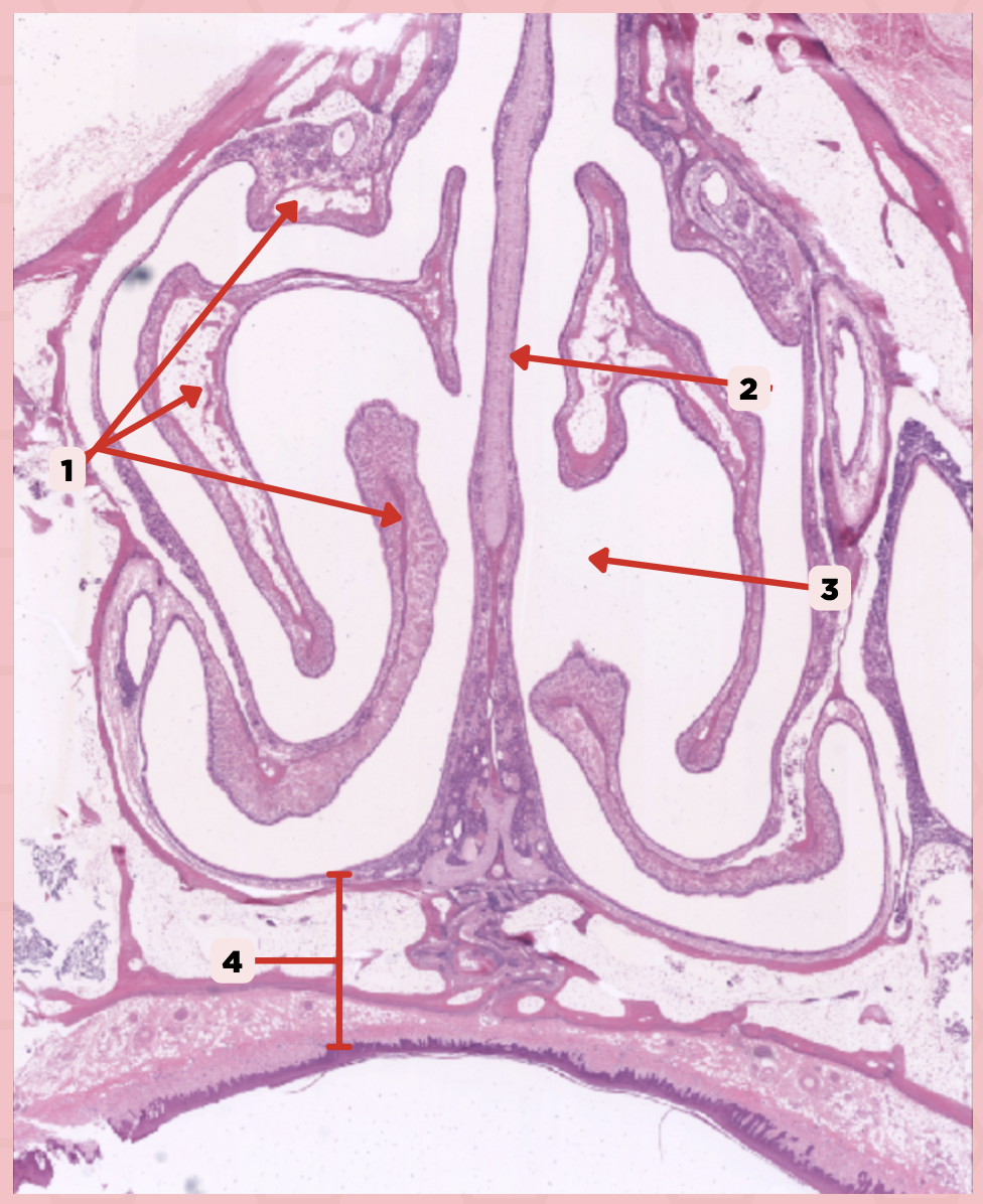 <p>Identify the type of epithelium of #2.</p>