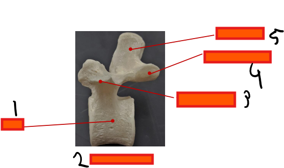 <p>what is this structure</p>