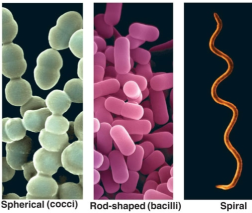 <p>Usually rod- shaped (bacillus) or spherical (coccus) cells</p><p>Less commonly: spiral cells known as spirochaetes</p>