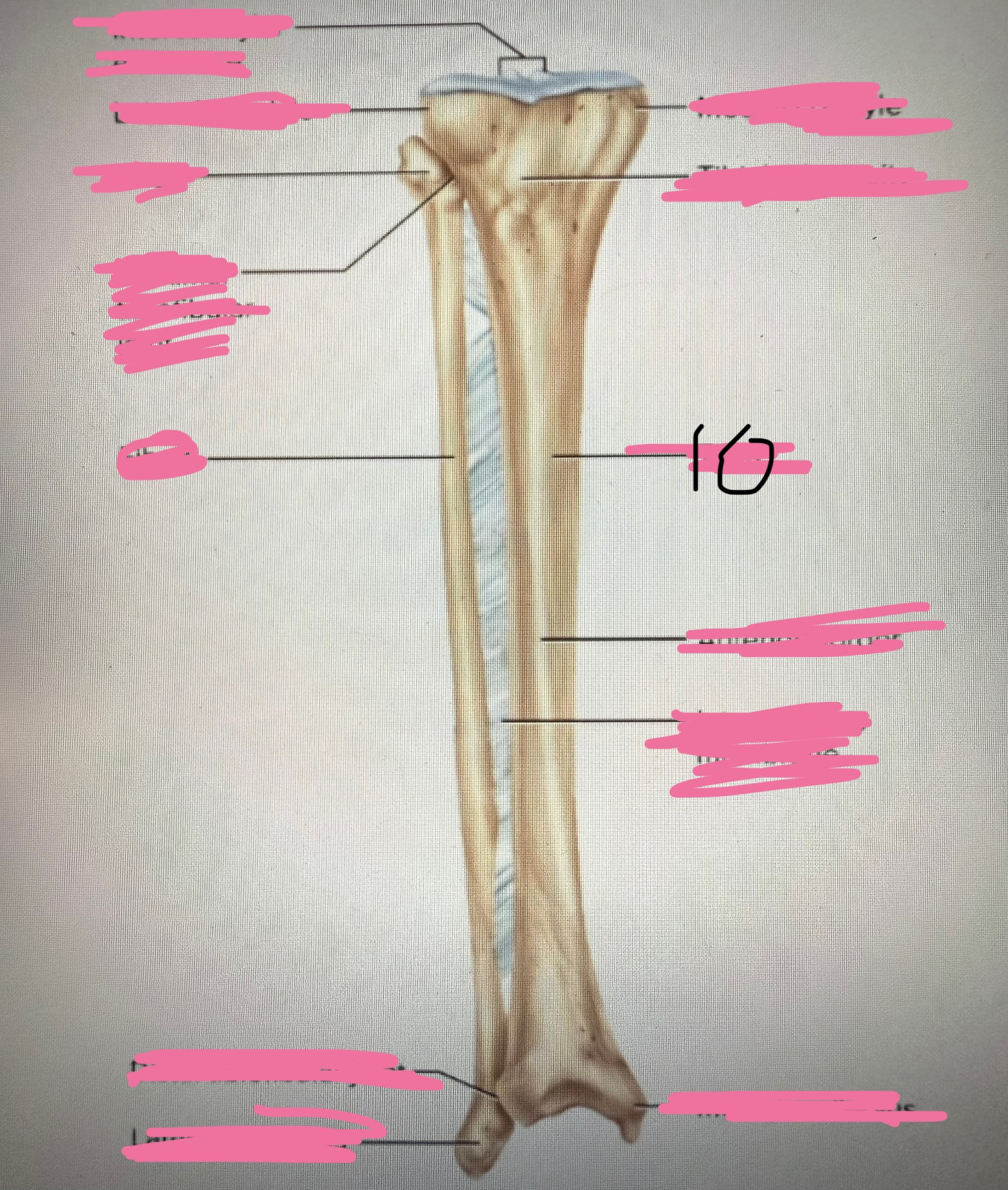 <p>10</p>