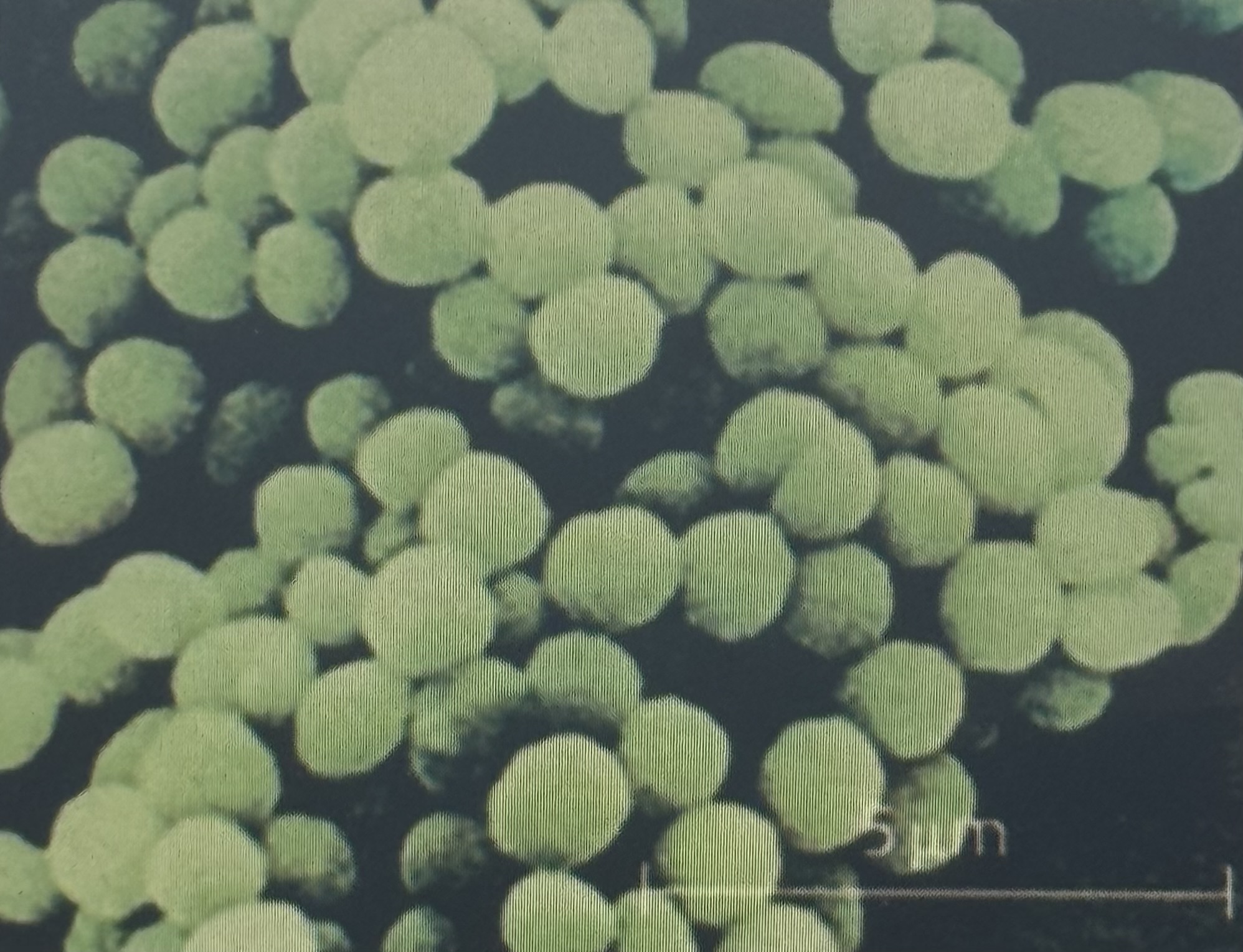 <p>Staphylococcus aureus Steckbrief</p>
