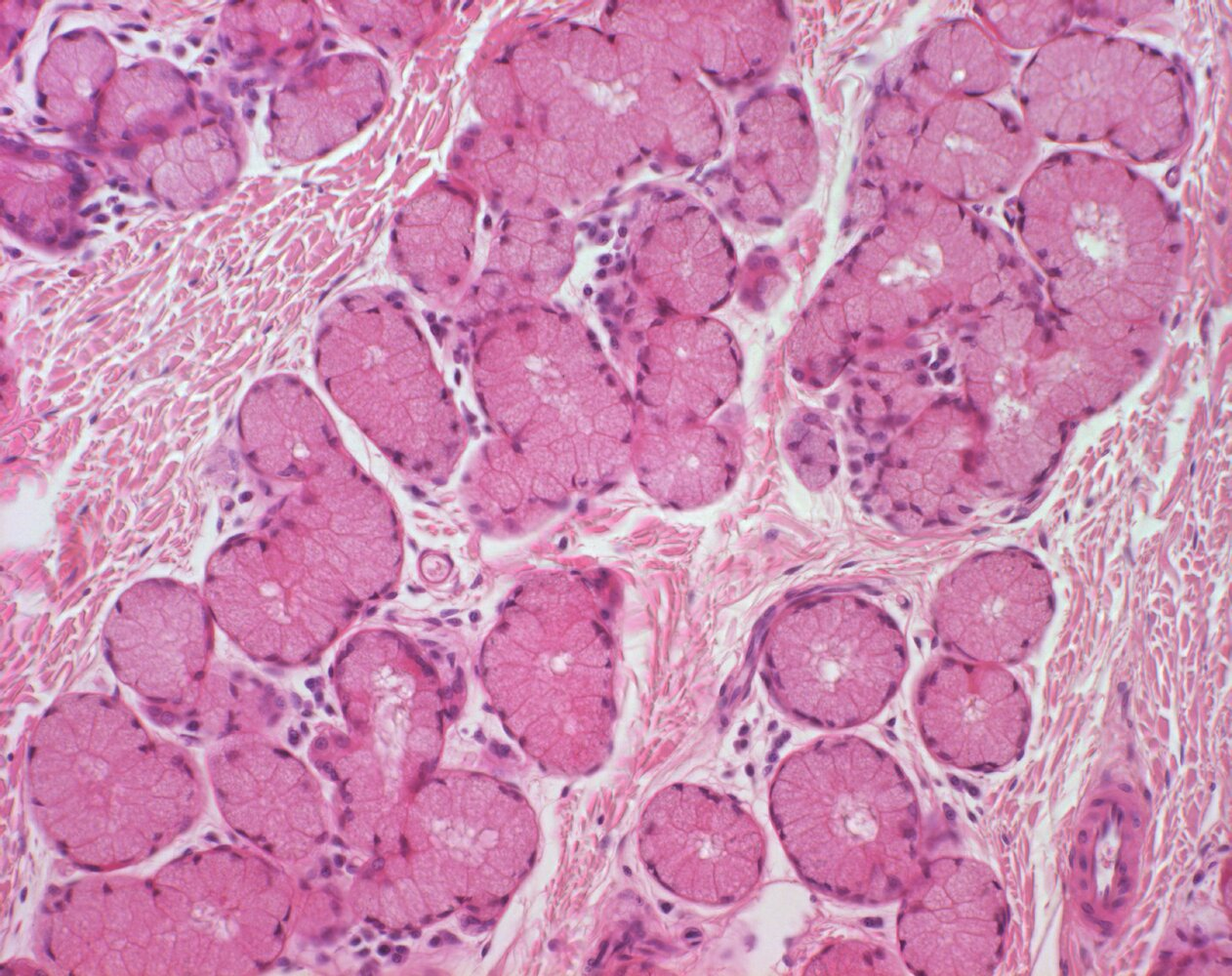 <p>10. The image shows the following structures:</p><p>A. Alveoli of the lactating mammary gland</p><p>B. Scent (apocrine) glands</p><p>C. Mucous glands</p><p>D. Sweat glands</p><p>E. Serous glands</p>