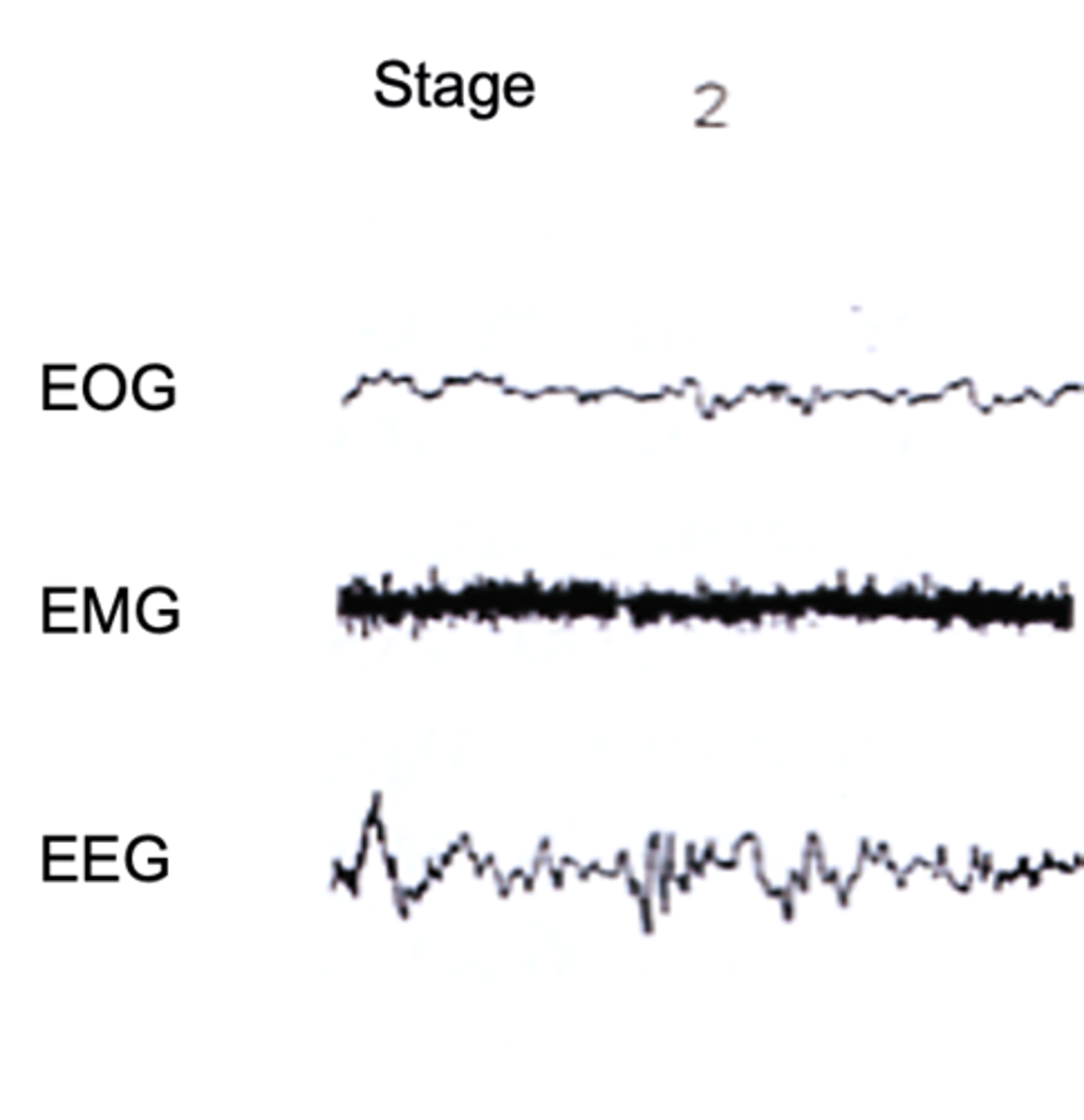 <p>K complexes occur ___________ against background of continuing ___-voltage EEG activity</p>