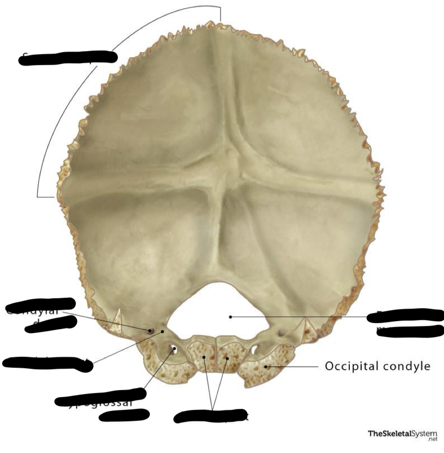 <p>occipital</p>