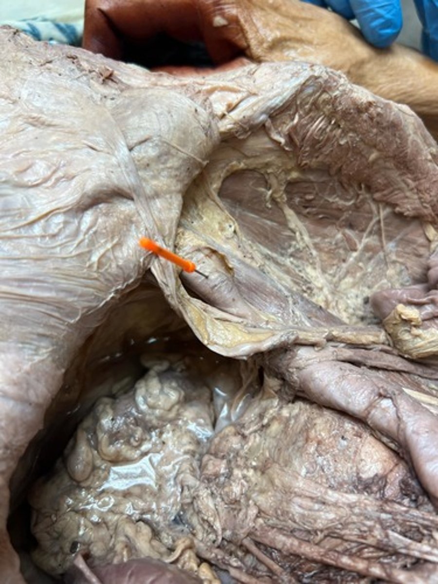 <p>external iliac artery</p>