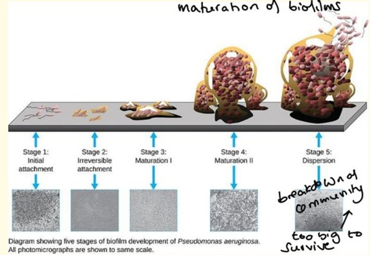 <p>Small community of microbes (microbial community) enclosed by extracellular material such as mineral crystals, blood and other substances.</p>