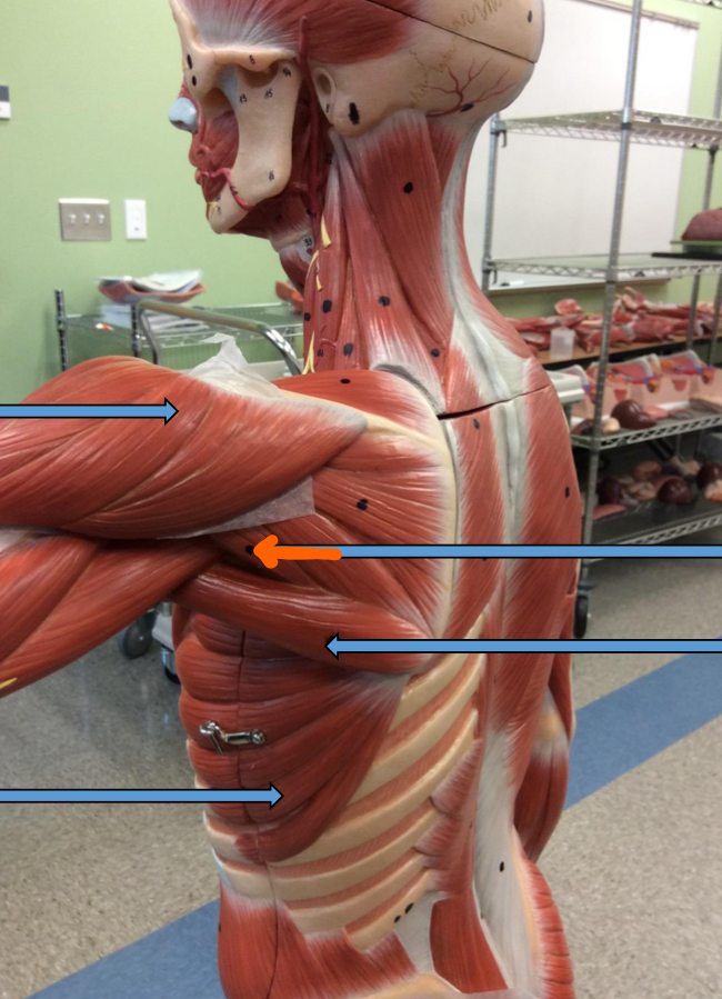 <p>Identify this muscle?</p>