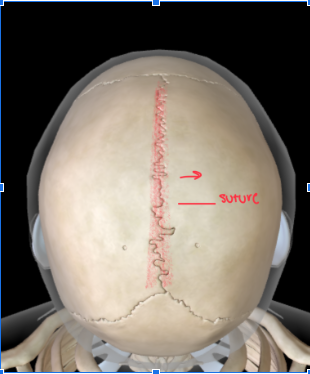 <p>This DIVIDES THE left and right PARIETAL BONES </p><ul><li><p>This <strong>DIVIDES LEFT AND RIGHT</strong>…what other plane divides the body left and right?</p></li><li><p>This is the TOP of the skull </p></li></ul><p></p>