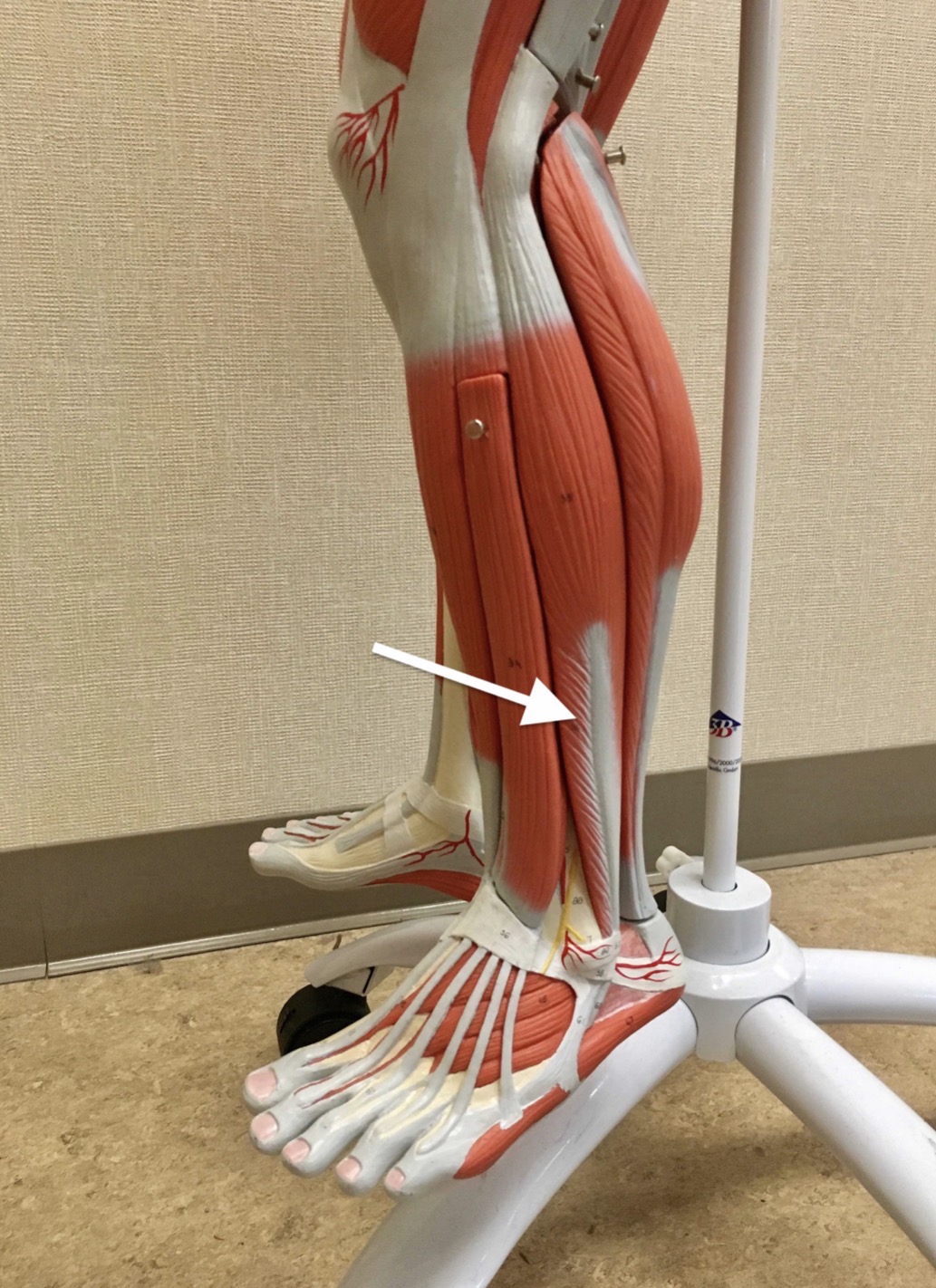 <p><span>Name the muscle labeled with the white arrow below:</span></p>