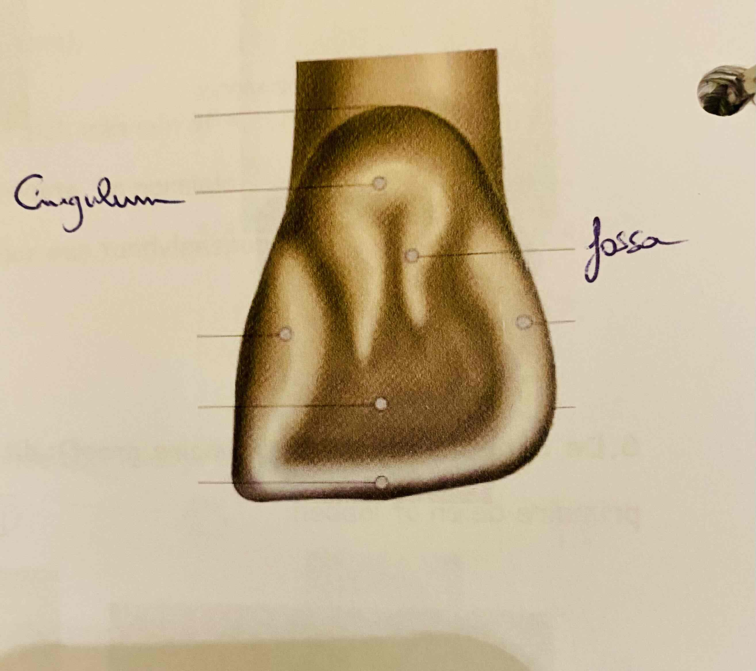 <p>Onregelmatige depressie of uitholling oh tandopp. (=concaaf)</p>