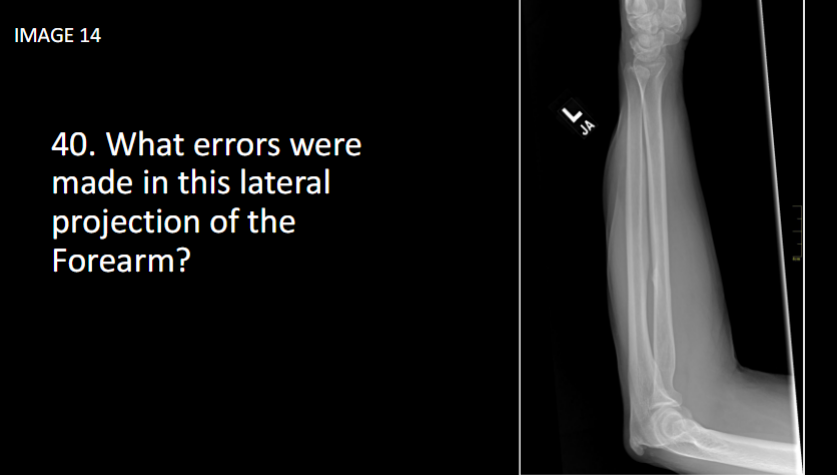 <p><span>What errors were made in this lateral projection of the Forearm?</span></p>