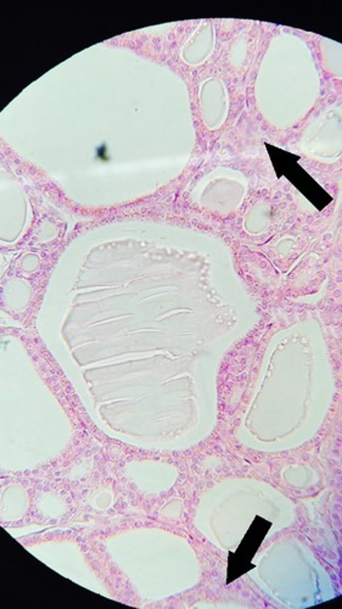 <p>A. Label B. Hormone made here</p>