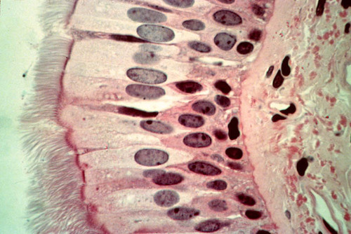 DESCRIPTION: tissue that consists of a single layer of irregularly shaped and sized cells that give the appearance of multiple layers
FUNCTION: secretes substances (mucus); propulsion of muses by ciliated action
LOCATION: nonciliated type in males sperm ducts and ducts of large glands.
ciliated found in trachea and the upper respiratory tract