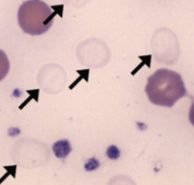 <p>Name the cells (black arrow)</p>