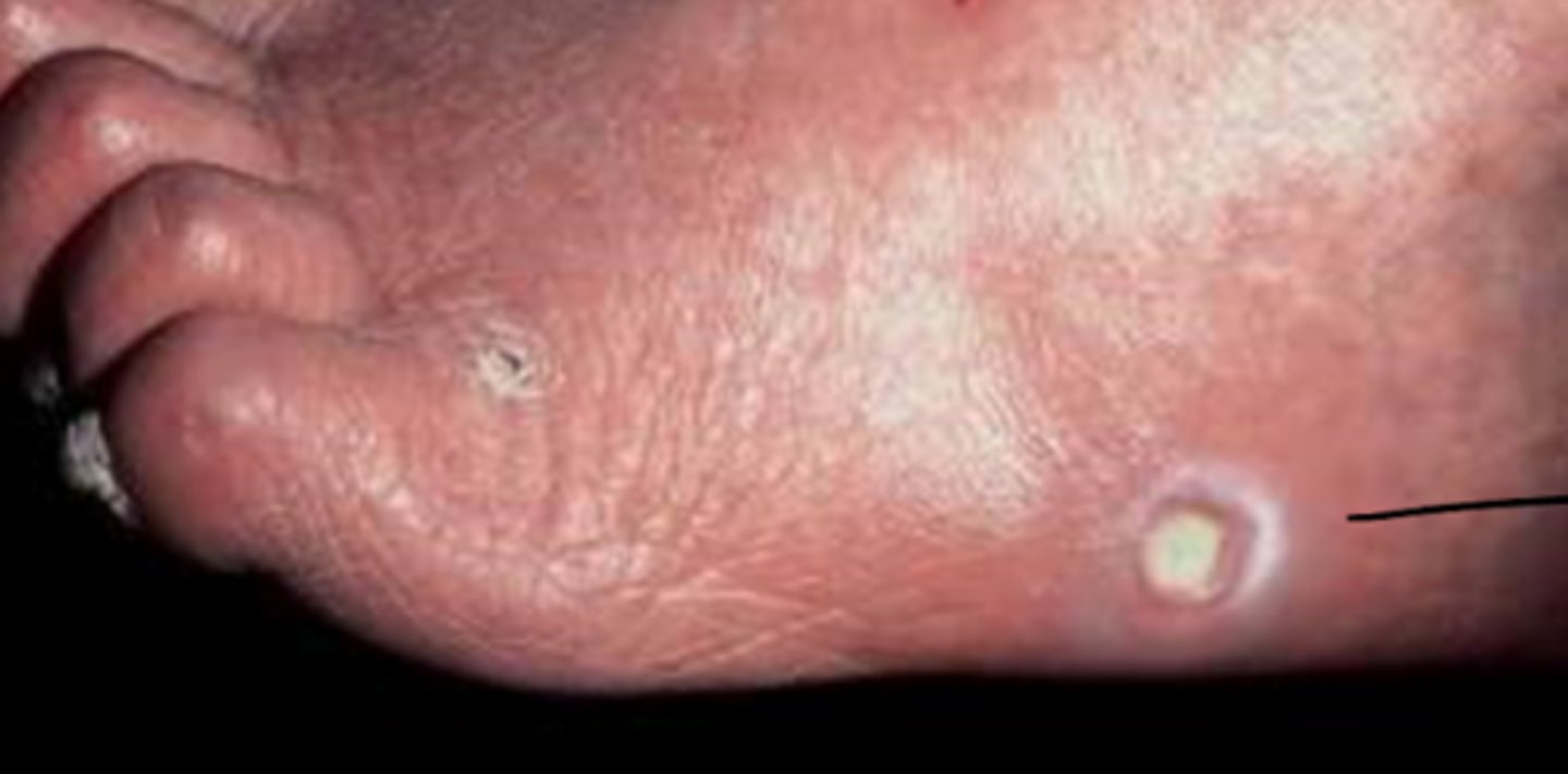 <p>What is the diagnosis?</p>
