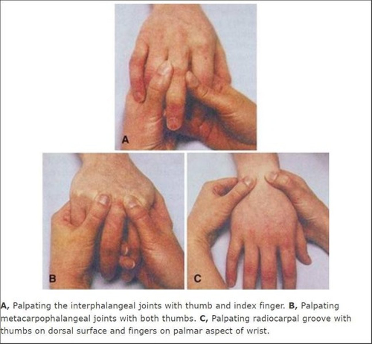 <p>Sensitive areas in muscles indicating myofascial pain.</p>