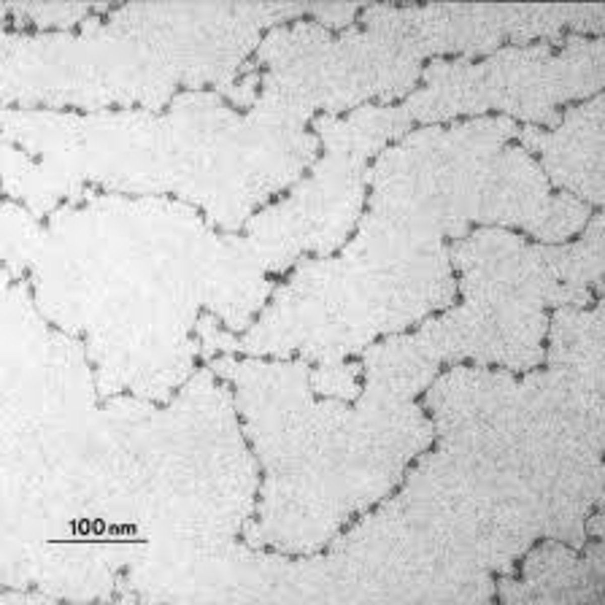 <p>Describe the arrangement of nucleosomes.</p>