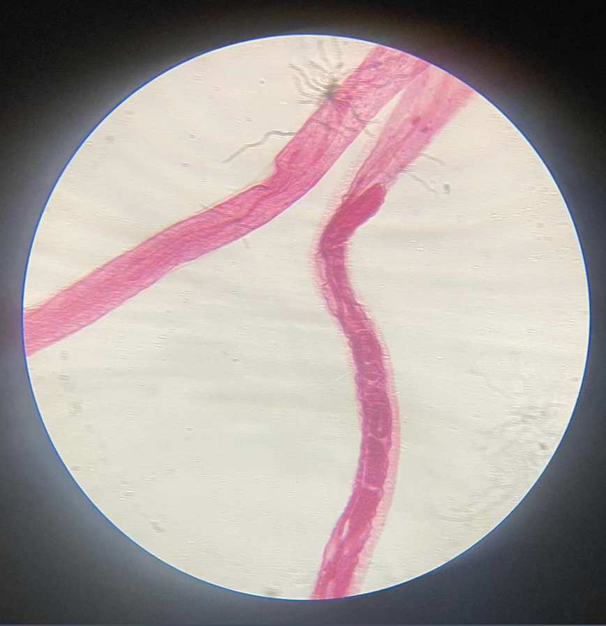 <p>vinegar eel; non-parasitic nematode found in native vinegar; ovoviviparous animal; female bigger than male; cylindrical body</p>