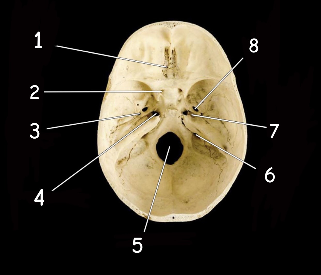 term image