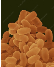 <p>gram (-)</p><p>coccbacillus</p>